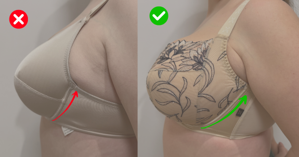 prima e dopo di una vestibilità del reggiseno. Nel prima la taglia è sbagliata e il ferretto poggia sul seno, provocando dolore. Nella seconda immagine, il ferretto si posiziona più distante dal seno, nella corretta posizione, grazie al bra fititng.